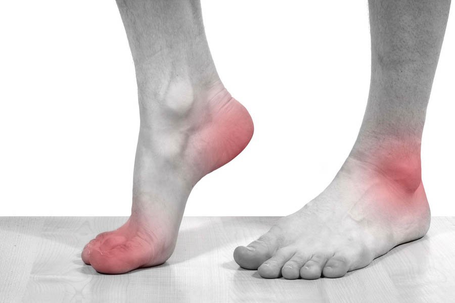 Tìm Hiểu Những Nguyên Nhân Bệnh Gout Và Biến Chứng 3 Tìm Hiểu Những Nguyên Nhân Bệnh Gout Và Biến Chứng